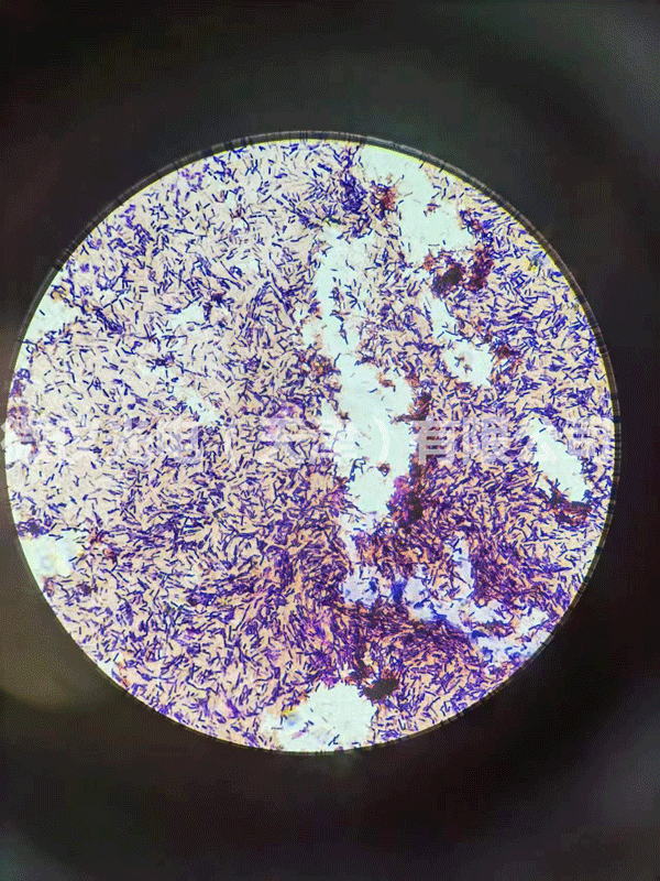 用麻豆国产视频网站光电蜜桃传媒AV免费观看麻豆下载进行芽孢及革兰氏染色杆菌的观察